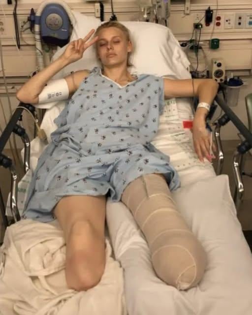 Her legs are amputated after using a common household product – Now she’s warning women everywhere