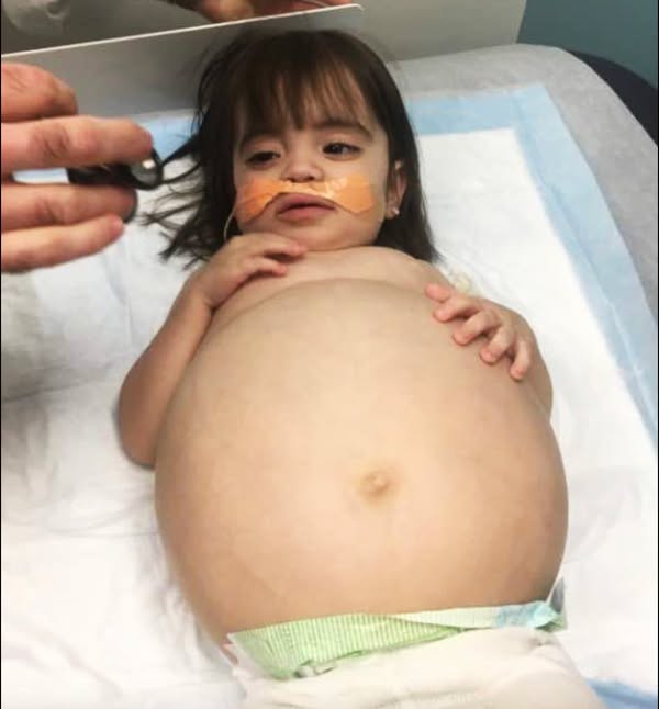 Little girl gets life-saving kidney operation thanks to her dad