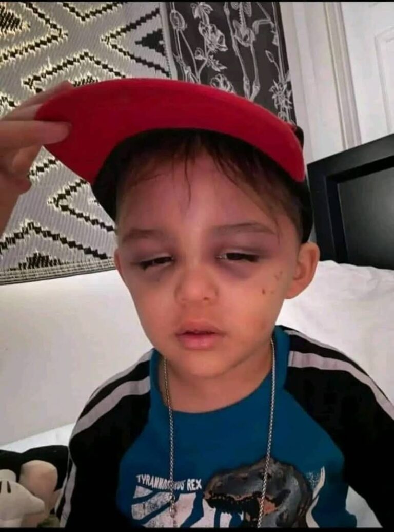A 3-year-old boy …