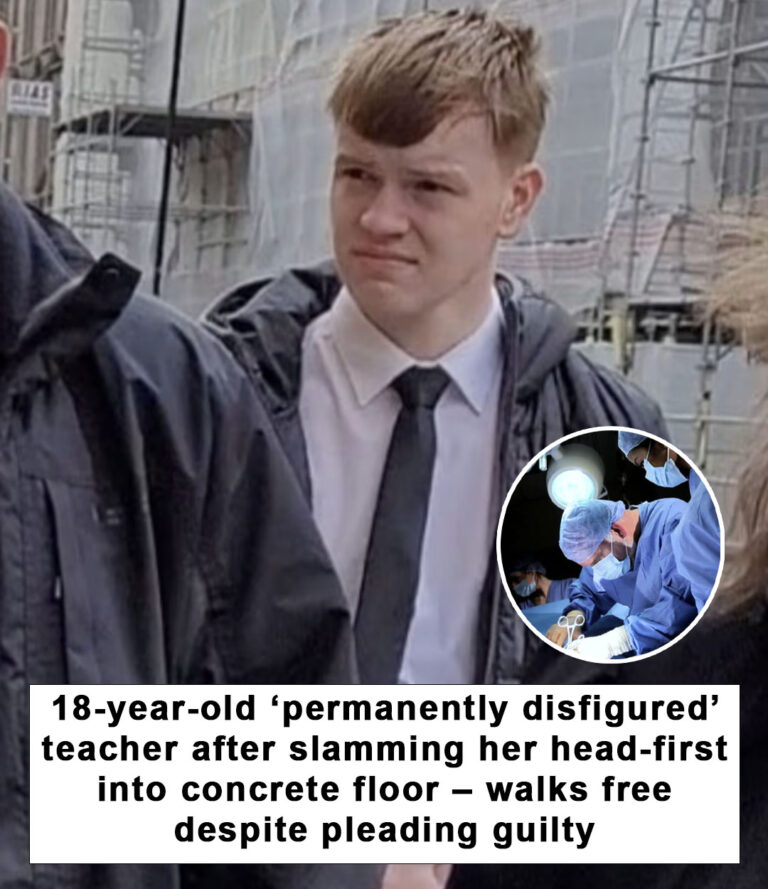 Teen who disfigures teacher avoids jail