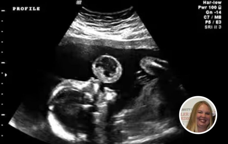 Mom Thinks Her Baby Is Blowing Bubble In Ultrasound, Then Doctors Discover What It Really Is