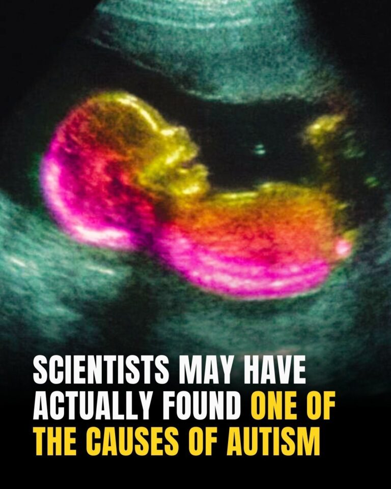 Scientists May Have Actually Found One Of The Causes Of Autism