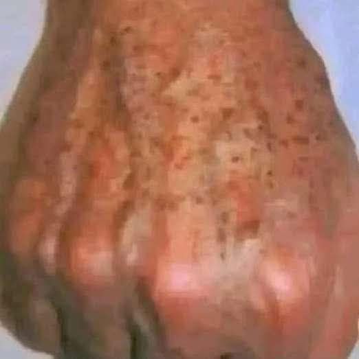 Did you know that if you get STAINS on your HANDS it’s because you have…