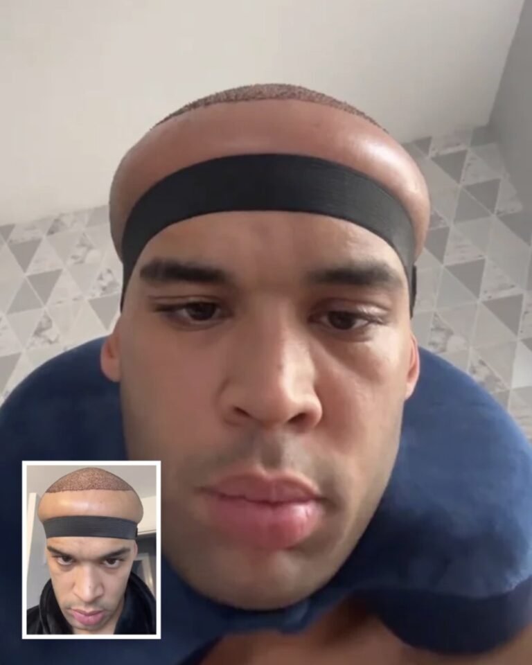 Man Issues Warning After Common Procedure Goes Horribly Wrong