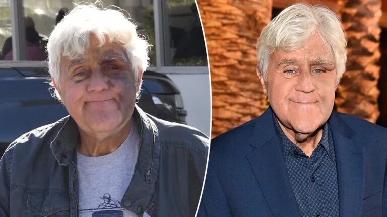 It breaks our hearts to confirm the news about the great Jay Leno, 74