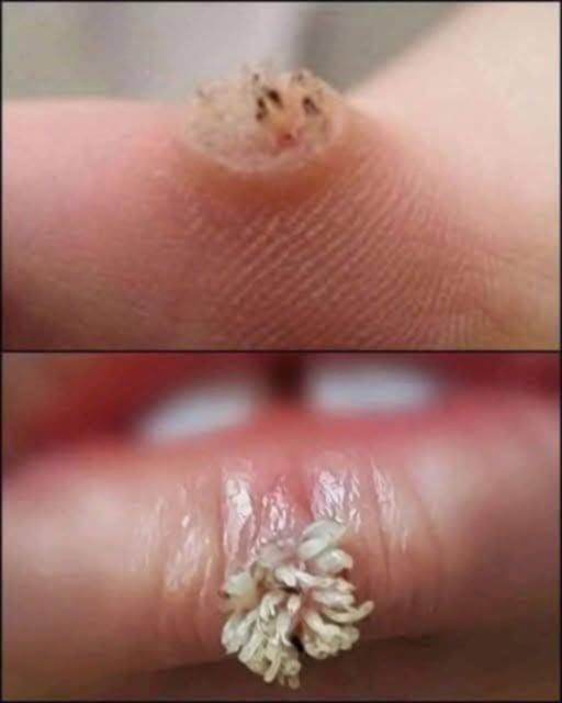 BE VERY CAREFUL . If you get this, you are infected with