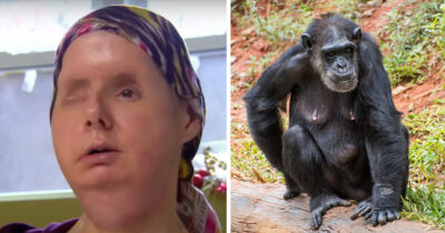 Woman who had face ripped off by friend’s pet chimp reveals sound she heard during attack