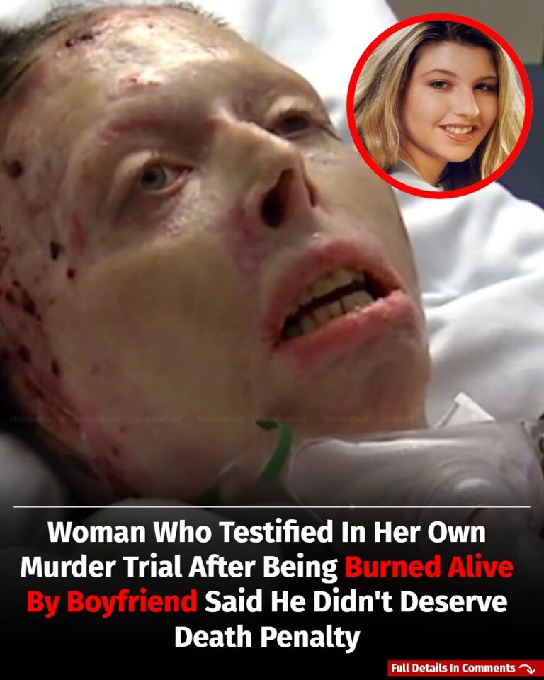 Woman Who Testified In Her Own Murder Trial After Being Burned Alive By Boyfriend Said He Didn’t Deserve Death Penalty