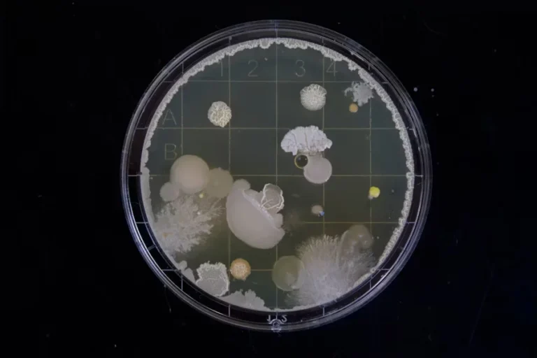 Deadly Waterborne Threat: Flesh‑Eating Bacteria Kills 4
