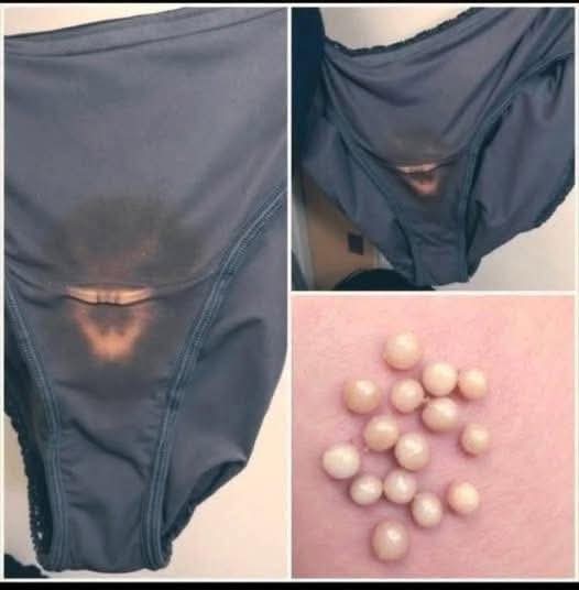If you find a “bleach” patch on your underwear, here’s what it means
