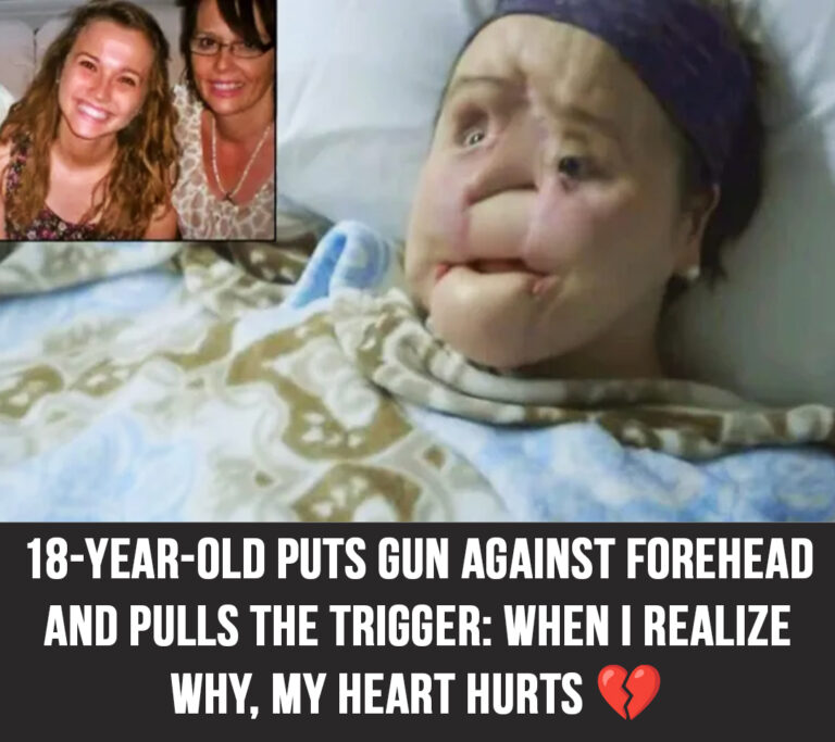 The amazing story of Katie Stubblefield: She became the youngest person to receive a face transplant