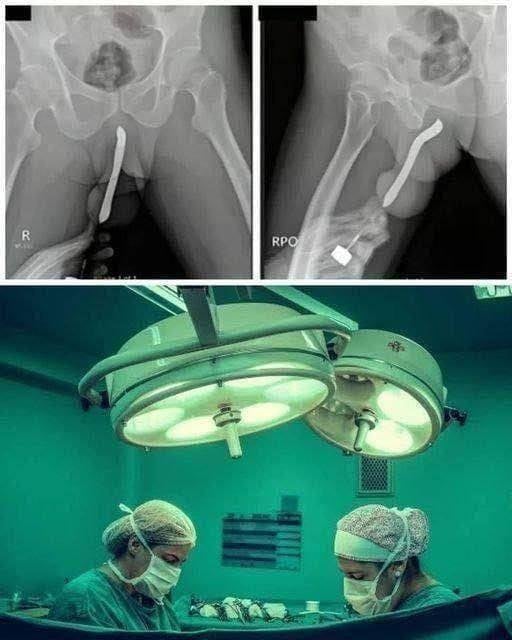 Girl had to be hospitalized for wanting to use a pe…See more