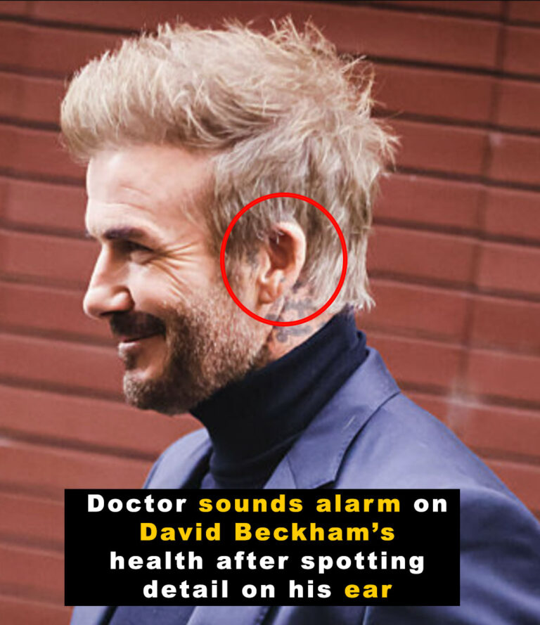 Doctor spots detail on David Beckham – gives major health warning