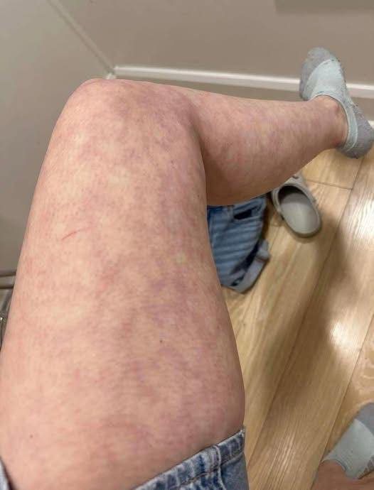 These are the consequences of sleeping with the…See more