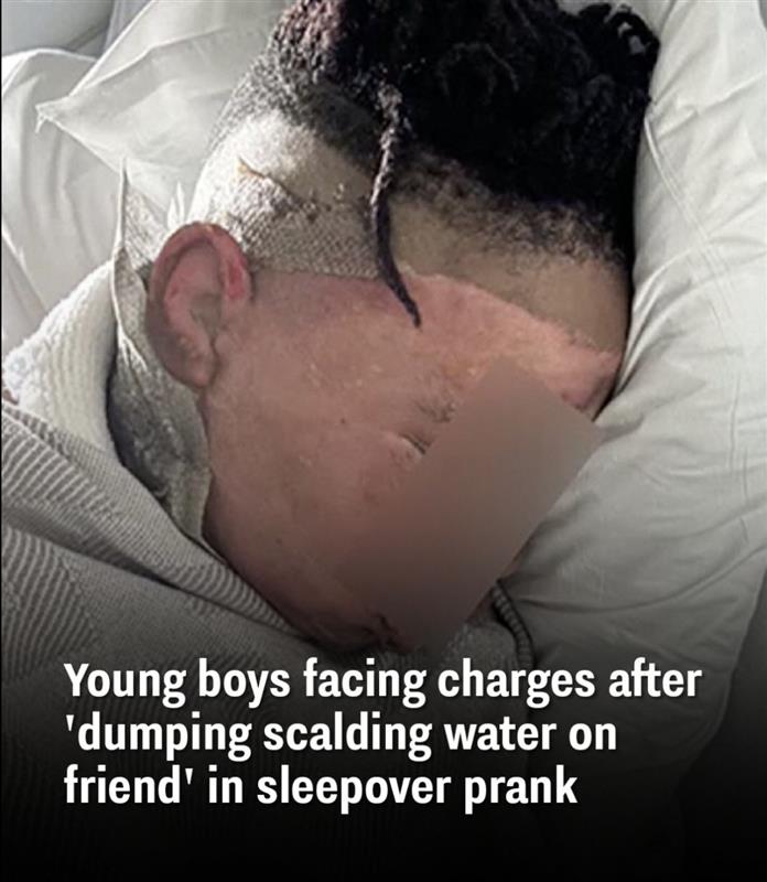 Georgia boy recovering after horrifying sleepover prank
