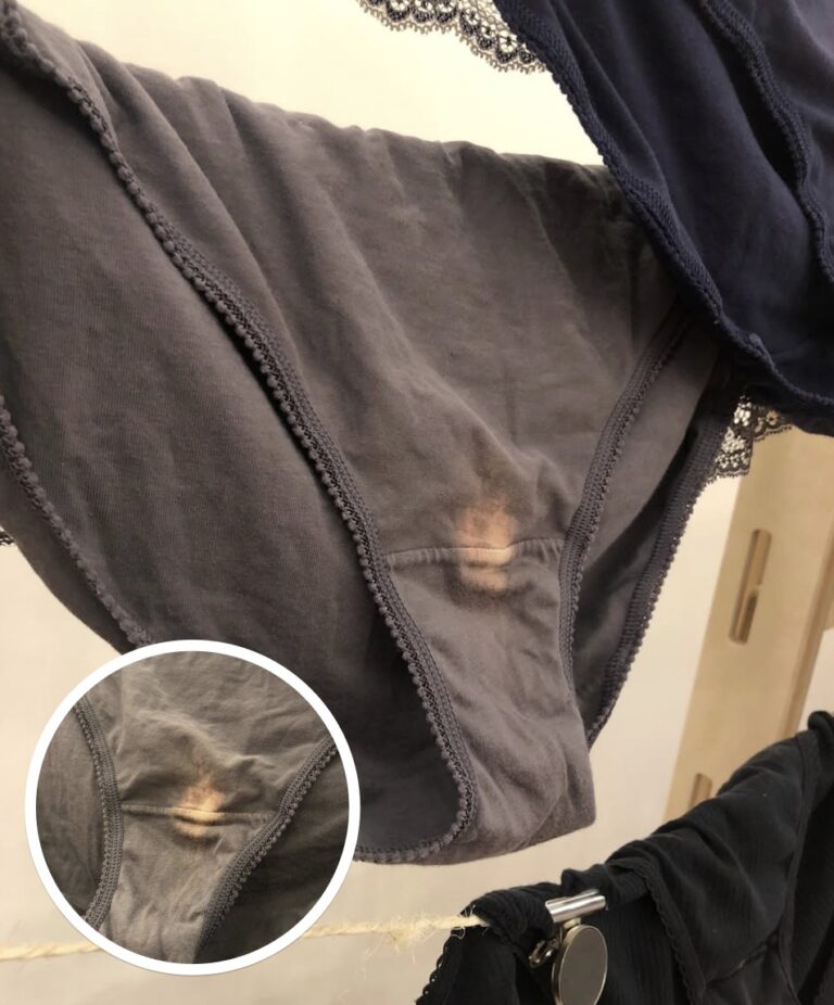 If You See A ‘Bleach’ Patch On Your Underwear, Here’s What It Means