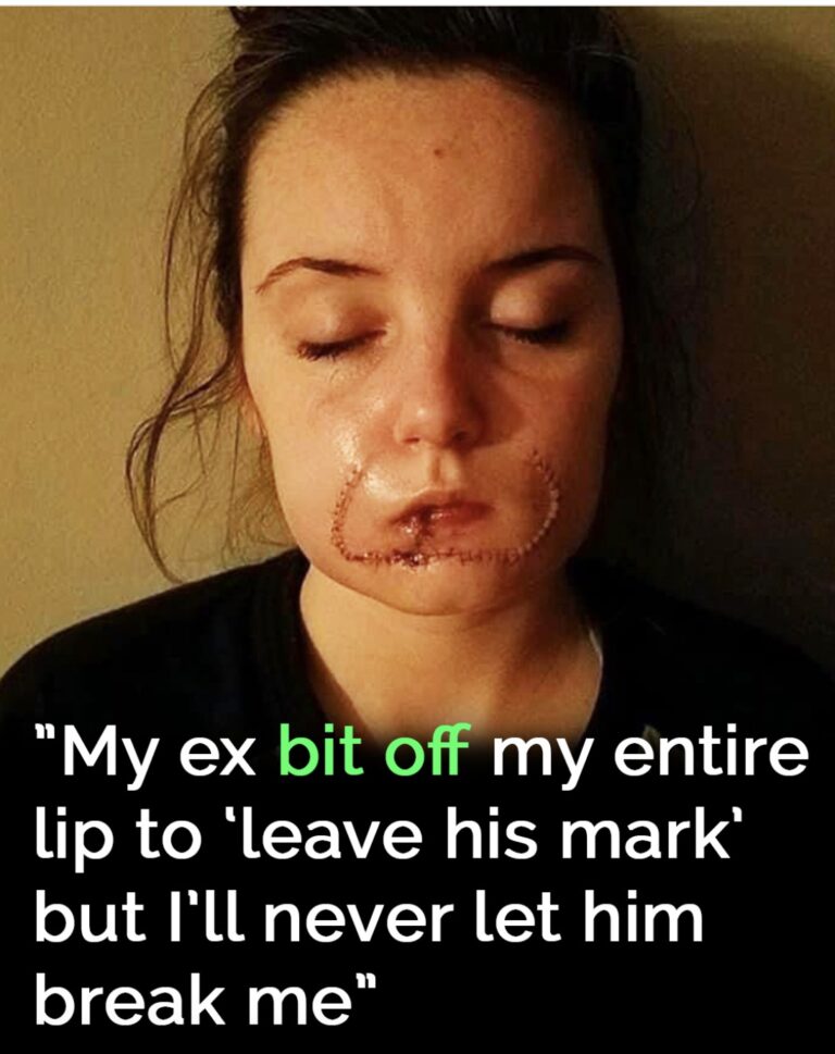 She thought it was love, but her ex left her scarred for life