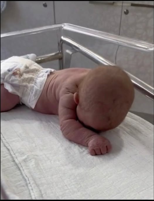 Wow – Baby born with an DIU peg! See more