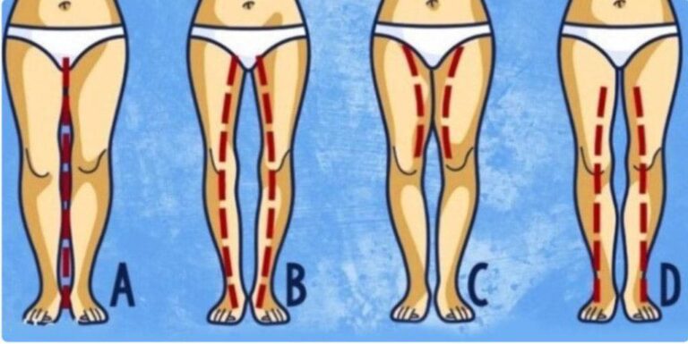 Silent Warnings In Her Legs