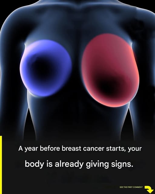 Breast Canc3r! 4 early signs every woman should know