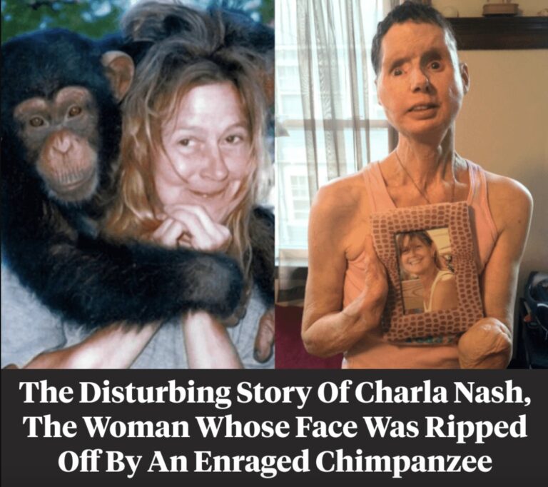 The sad story of Charla Nash, the woman whose face was ripped off by an chimpanzee