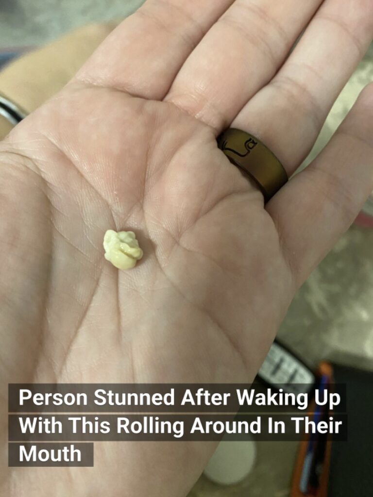 Person Stunned After Waking Up With This Rolling Around In Their Mouth