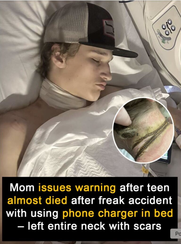 Mom warns after teen almost dies in freak phone charger accident