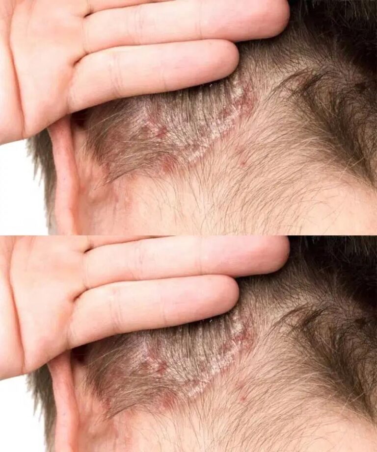 I discovered something on my son’s scalp and have no clue what it is. Doctor’s appointments aren’t available soon—any tips?