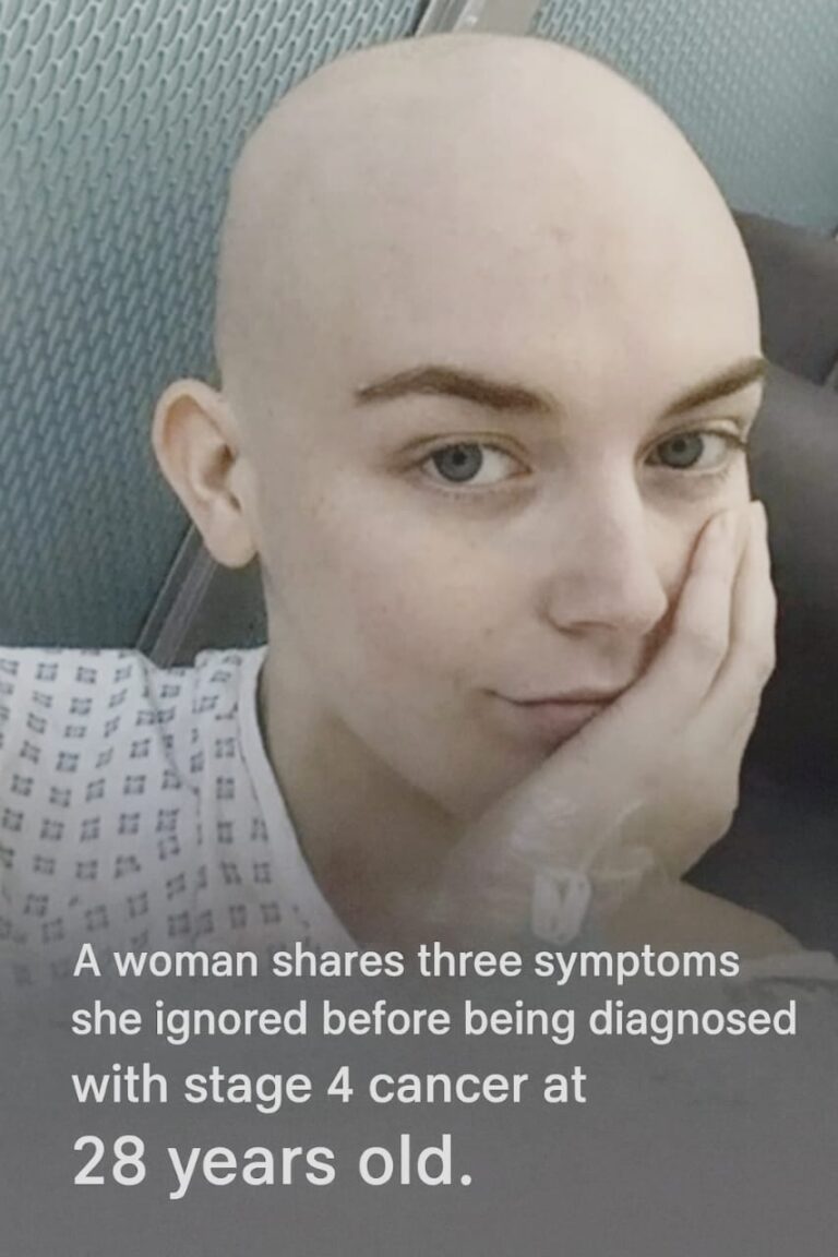 A woman reveals three symptoms she overlooked before her stage 4 cancer diagnosis at age 28