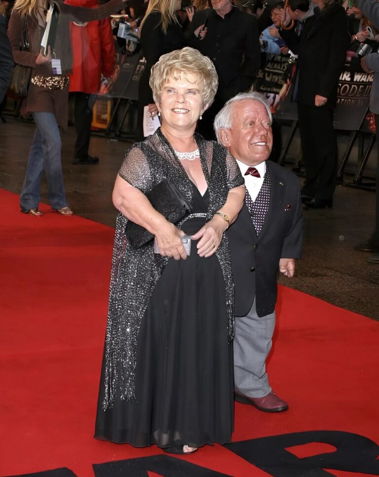 Measuring only 112 cm in height, the actor chose a life partner who was only slightly taller than him . Although doctors cautioned that their children might be born with the same condition, the dwarf couple welcomed two children . Their children’s appearance was shown in…