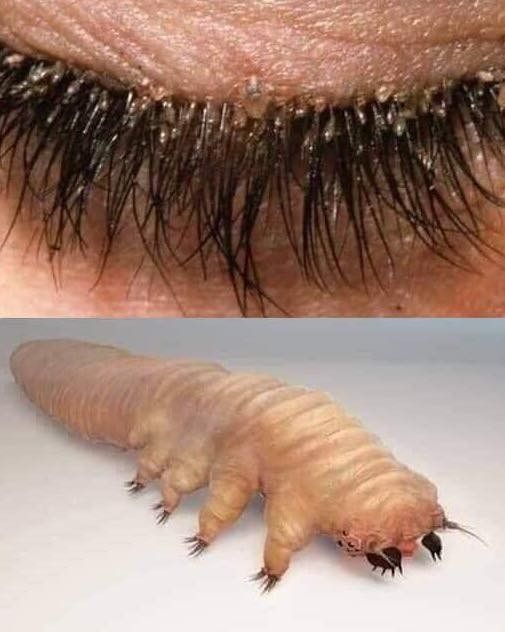 How To Spot Eyelash Mites