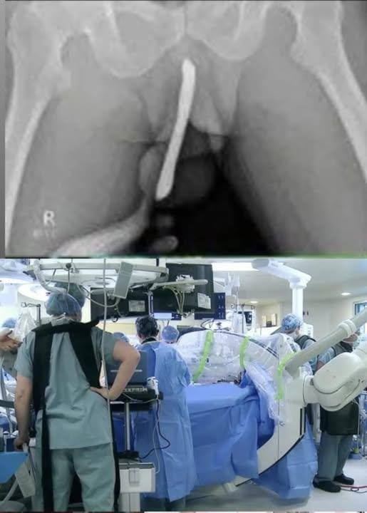 Young Girl Hospitalized After Attempting to Use a Personal Device