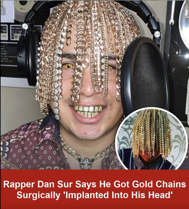 Rapper had surgery to get gold chains implanted into his skull