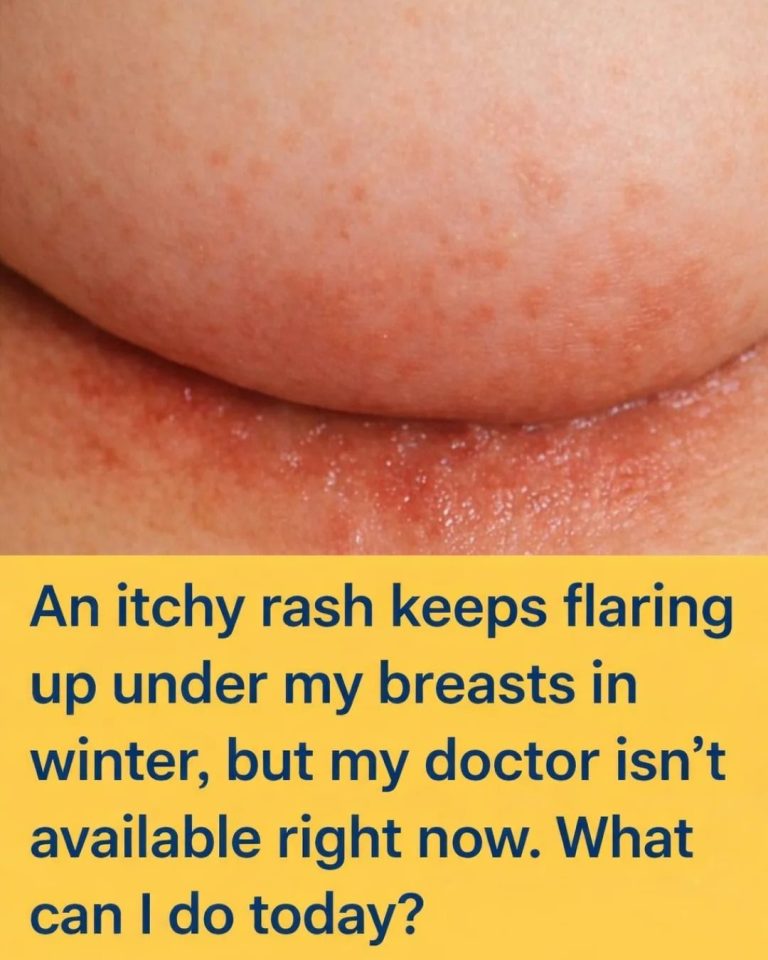 An itchy rash keeps flaring up under my breasts in winter, but my doctor isn’t available right now. What can I do today?