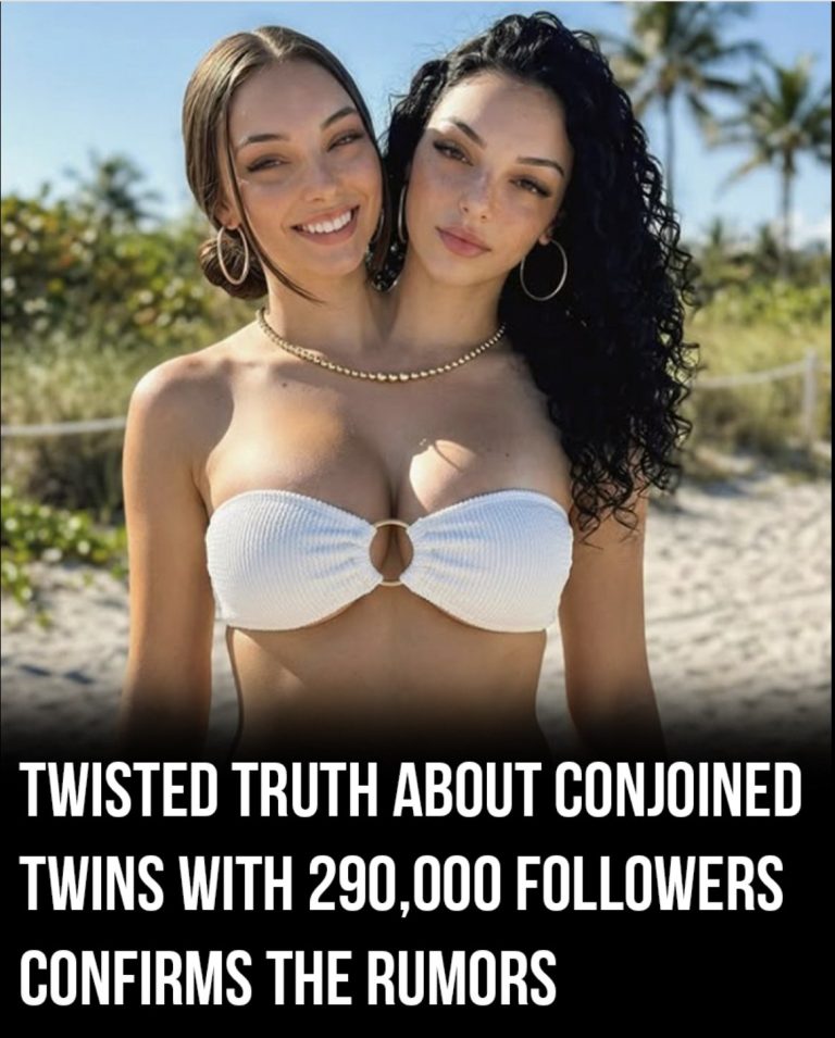 Shocking Reality Behind Viral “Conjoined Twins” With Nearly 300,000 Followers Sparks Online Debate