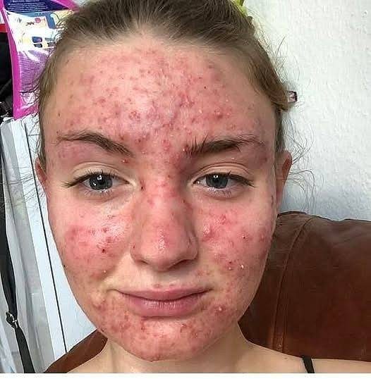 Her Body Was Itchy — He Thought It Was Just an Allergy, But Then This Happened